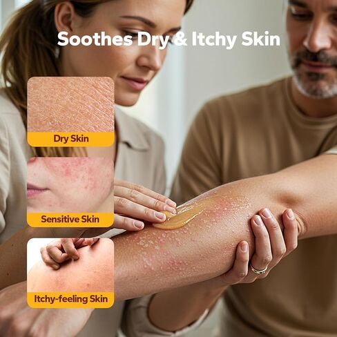 كريم عسل مانوكا (4.1 أونصة سائلة)، كريم الأكزيما للبالغين، غسول الأكزيما للوجه والجسم، مرهم عسل مانوكا الطبيعي لتهدئة البشرة الجافة والحكة، مرطب لتخفيف حكة الجلد in Kuwait