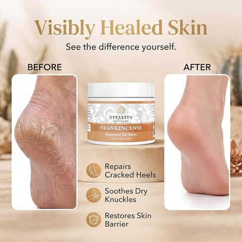 بلسم اللبان بمستخلصات حيوية - 2 أونصة، بوسويليا سيراتا، شمع العسل، زيت الزيتون، مرطب للبشرة الجافة والمتشققة، جميع أنواع البشرة in Kuwait