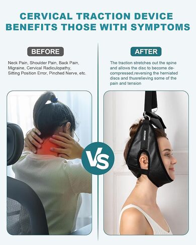 جهاز جر عنق الرحم للاستخدام المنزلي - جهاز جر عنق الرحم فوق الباب لتخفيف الضغط والعلاج الطبيعي المنزلي، جهاز جر الرقبة المحمول لألم الرقبة (مع صندوق) in Kuwait