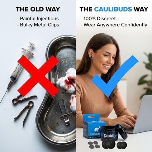 ضغط الجدرة للجُدرات - 4 قطع من مغناطيس الأذن القرنبيط مغطى بالسيليكون المضاد للحساسية - مشبك ضغط الجدرة لدعم تعافي القرنبيط in Kuwait