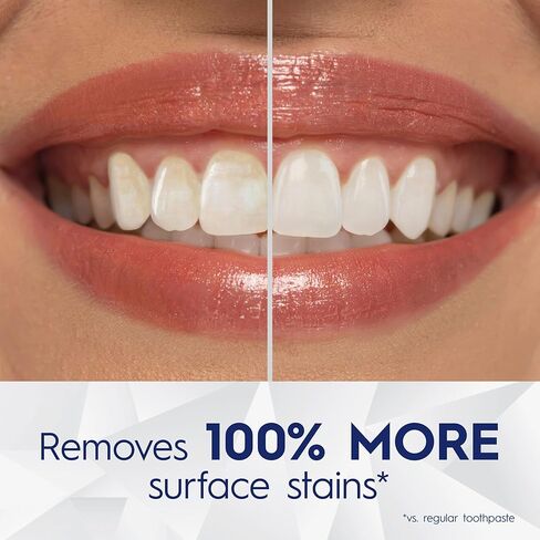 معجون أسنان كريست 3D وايت بريليانس بلاست لتبييض الأسنان، 4.6 أونصة، معجون أسنان مضاد للتجويف بالفلورايد، إزالة البقع السطحية بنسبة 100%، منع البقع بشكل نشط لمدة 24 ساعة in Kuwait