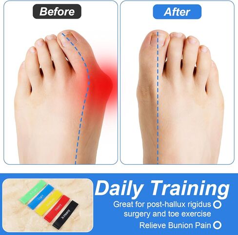 Sibba 5Pcs Toe Resistance Bands Toe Stretcher Bands for Bunion Correction Bunion Relief Toes Strength Foot Exercise Band for Hallux Valgus Yoga Daily Toes Training in Saudi Arabia