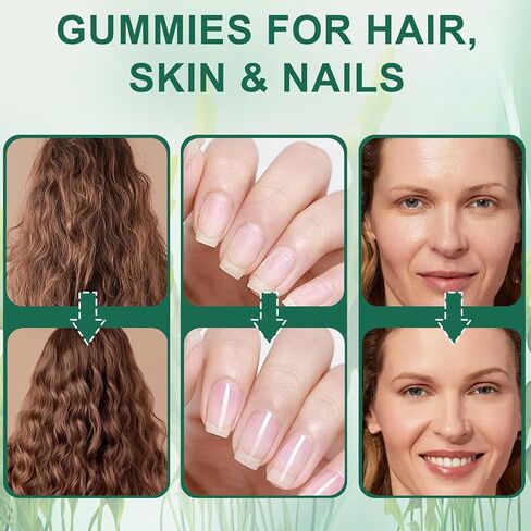 Hair Loss Gummies,Sea Moss Gummies with Vitamin C, Vitamin E, Aloe Vera, Pearl Powder Support Faster Hair Growth,Enhance Nail Elasticity,Promot Radiant Skin,Gluten-Free - 60 Count in Kuwait