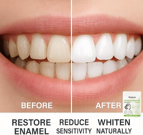 مسحوق هيدروكسيباتيت نقي 100% 75 جم (2.65 أونصة) | مسحوق هيدروكسيباتيت نانو للأسنان | معجون أسنان DIY، تبييض الأسنان وصناعة الصابون in Kuwait