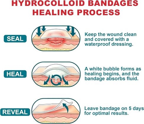 Dodanros Advanced Fast Healing Hydrocolloid Gel Bandages, Adhesive Wound Care Pads, 2.32 * 1.14 in, 40 Count in Kuwait