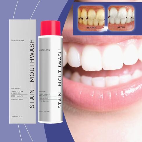 غسول الفم المبيض للبقع من آي دي، غسول الفم المزيل للبقع للحصول على نفس منعش، غسول الفم بيروكسيد الهيدروجين لتعزيز بياض الأسنان، شطف بيروكسيد بالزيوت العطرية 237 مل in Kuwait