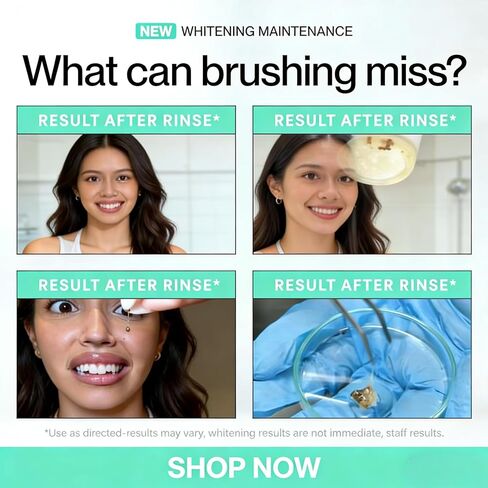 غسول الفم المبيض للبقع من آي دي، غسول الفم المزيل للبقع للحصول على نفس منعش، غسول الفم بيروكسيد الهيدروجين لتعزيز بياض الأسنان، شطف بيروكسيد بالزيوت العطرية 237 مل in Kuwait