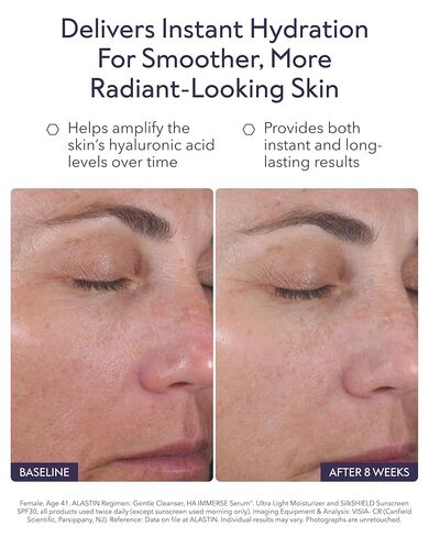 مصل ALASTIN للعناية بالبشرة بحمض الهيالورونيك HA IMMERSE لترطيب الوجه (1 أونصة) | مصل مجدد يكافح البشرة الجافة والمجففة | لبشرة مشرقة ومتوهجة in Kuwait