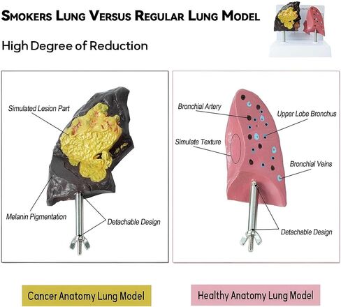 Smoker's Lung vs Healthy Lung Comparative Model - Life Size Anatomical Display for Medical Education, Respiratory Health Study Tool with Pathological Features, PVC Structure in Saudi Arabia