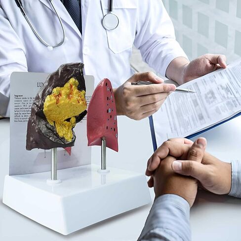 Smoker's Lung vs Healthy Lung Comparative Model - Life Size Anatomical Display for Medical Education, Respiratory Health Study Tool with Pathological Features, PVC Structure in Saudi Arabia