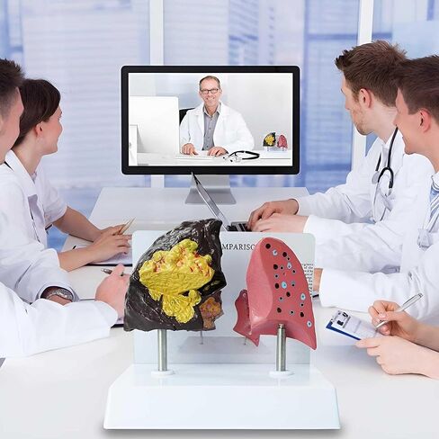 Smoker's Lung vs Healthy Lung Comparative Model - Life Size Anatomical Display for Medical Education, Respiratory Health Study Tool with Pathological Features, PVC Structure in Saudi Arabia