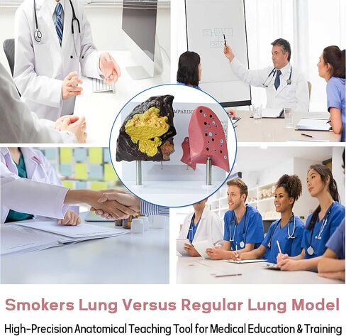 Smoker's Lung vs Healthy Lung Comparative Model - Life Size Anatomical Display for Medical Education, Respiratory Health Study Tool with Pathological Features, PVC Structure in Saudi Arabia