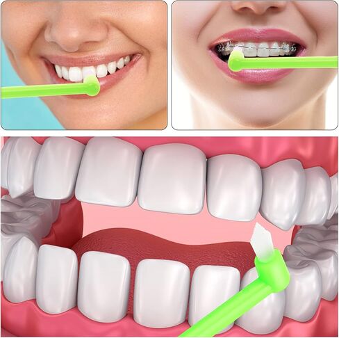 فرشاة أسنان Ouligay 4 قطع للكبار، فرشاة نهاية Tuft، فرشاة أسنان واحدة معنقدة لتقويم الأسنان للأقواس، رأس صغير فرشاة بين الأسنان لتنظيف التفاصيل in Kuwait
