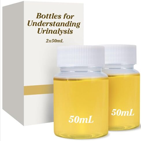 2x50mL Bottles for Understanding Urinalysis, Demonstration of Urinalysis Techniques, Education and Lab Testing for Urine Analyze, Artificial Substitute in Kuwait