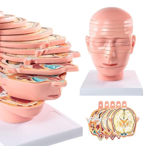 EVOTECH SCIENTIFIC Human Head and Brain Cross-Section Anatomy Model, 12 Parts Human Brain Anatomy Model Slice Horizontal with Mark for Medical Education Learning Study in Saudi Arabia