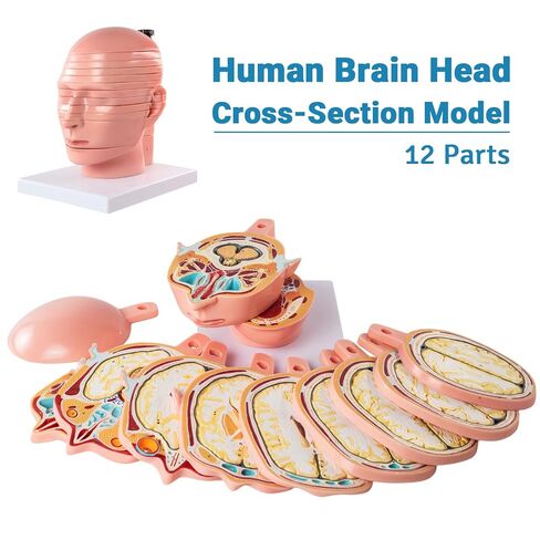 EVOTECH SCIENTIFIC Human Head and Brain Cross-Section Anatomy Model, 12 Parts Human Brain Anatomy Model Slice Horizontal with Mark for Medical Education Learning Study in Saudi Arabia