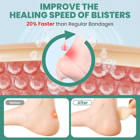 ضمادات فقاعية للقدم - 21 قطعة من ضمادات الغروانية المائية للوقاية من البثور والتعافي منها، وسادات فقاعية لحماية الكعب وأصابع القدم - عبوة متنوعة in Kuwait