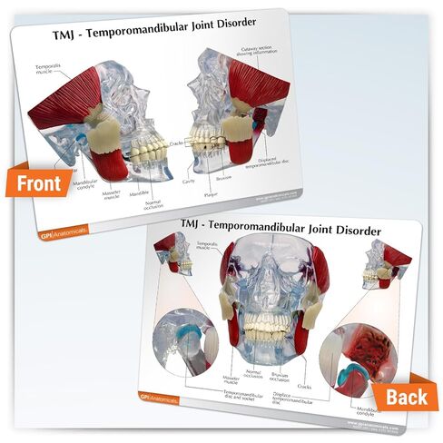 GPI Anatomicals - Temporomandibular Joint (TMJ) Model, Replica with Pathologies for Human Anatomy and Physiology Education, Anatomy Model for Doctor's Offices and Classrooms, Medical Study Supplies in Kuwait