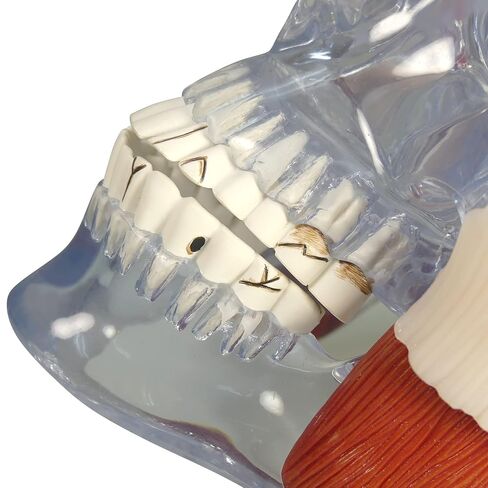 GPI Anatomicals - Temporomandibular Joint (TMJ) Model, Replica with Pathologies for Human Anatomy and Physiology Education, Anatomy Model for Doctor's Offices and Classrooms, Medical Study Supplies in Kuwait