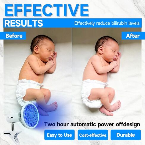 Jaundice Light Therapy Newborn, Bilirubin Light Lamp for Jaundice Baby, Neonatal Baby Jaundice Treat Blue Ray Light, Portable Infant Bilirubin Light with 18 Led Light, Biliblanket Light with Eye Mask in Saudi Arabia