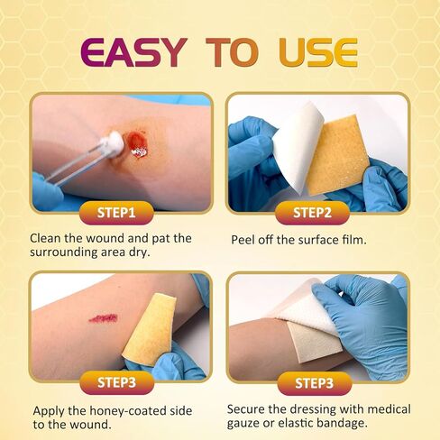 Honey Calcium Alginate Wound Dressing – 2"x2" 10 Packs – Medical Grade Manuka Honey, High Absorbency, Forms Gel & Non-Stick – for Chronic Wounds, Post-Surgery, Pressure Injuries, Burns, Cuts in Saudi Arabia