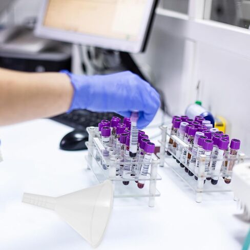 5pcs 100mm Plastic Triangle Laboratory Funnel Set, Pp Scientific Filling Funnels for Liquid Transfer and Experiment Use in Kuwait