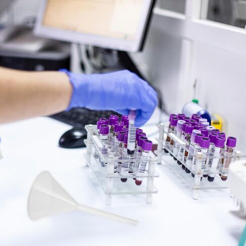 10pcs 90mm Plastic Filling Funnels Set Laboratory Filter Funnels Triangular Pp for Scientific Experiments and Liquid Transfer in Kuwait