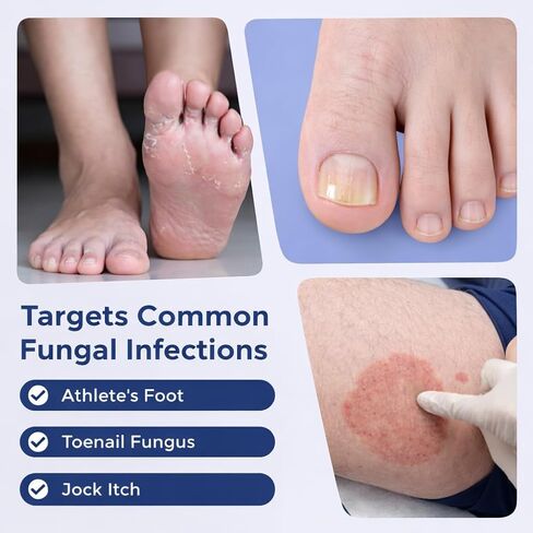 FSA Eligible HSA Extra Strength Athlete‘s Foot & Toenail Fungus Treatment Pen – Maximum OTC Antifungal with 25% Undecylenic Acid, Precision Applicator for Itch Relief & Nail Care in Saudi Arabia