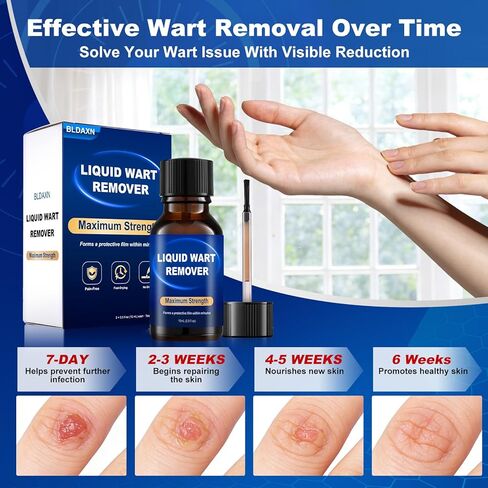 Fast-Acting Wart Remover Freeze Off & Corn Remover, 2-Pack 30 ml Salicylic Acid Plantar Wart Remover for Feet, Hands & Skin - Professional Wart Removal, NDC Code: 76986-024 in Saudi Arabia