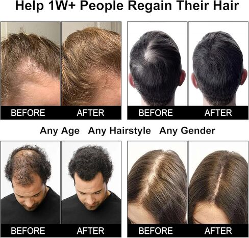 Red Light Therapy Hair Growth Cap, Laser Hair Growth Cap for Men and Women in Saudi Arabia