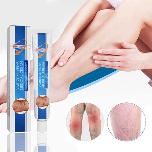 Vericose Veins Treatment Blue Light Lazer Treatment Pen,Spider Vein Treatment for Legs,Varicose Veins Blue Light Therapy Set in Saudi Arabia
