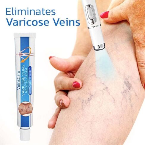 Vericose Veins Treatment Blue Light Lazer Treatment Pen,Spider Vein Treatment for Legs,Varicose Veins Blue Light Therapy Set in Saudi Arabia