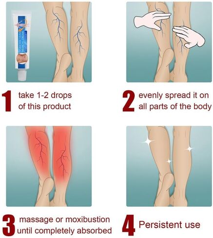 Vericose Veins Treatment Blue Light Lazer Treatment Pen,Spider Vein Treatment for Legs,Varicose Veins Blue Light Therapy Set in Saudi Arabia
