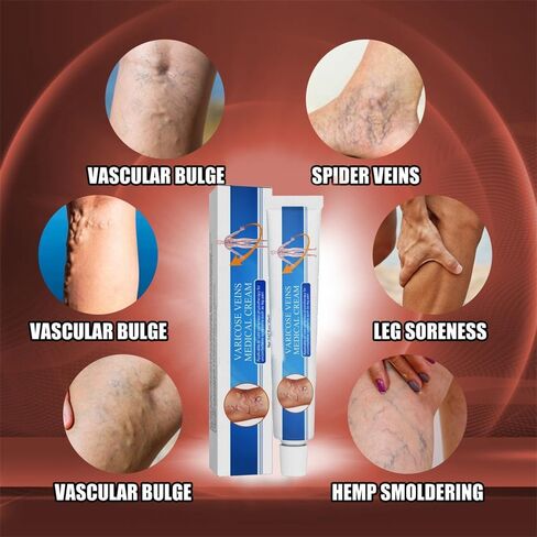 Vericose Veins Treatment Blue Light Lazer Treatment Pen,Spider Vein Treatment for Legs,Varicose Veins Blue Light Therapy Set in Saudi Arabia