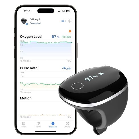 جهاز قياس الأكسجين Wellue O2Ring-S مع تذكير بالاهتزاز، ومقياس التأكسج النبضي بتقنية البلوتوث يتتبع SPO2 ومعدل النبض، وعمر البطارية 24 ساعة، وذاكرة مدمجة 4*10 ساعات، ونبض نبض قابل لإعادة الشحن مع جهاز كمبيوتر وتطبيق مجاني in Kuwait