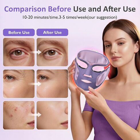SUNVIVI LED Light Therapy Mask RT01, FDA 510K Cleared Class 2, Red Blue NIR Light for Acne & Wrinkles, Home Use Phototherapy Device with Eyelid Heating Pad, 10 Mins Treatment in Saudi Arabia