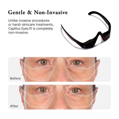 Capillus Eyelift Red Light Therapy for Eyes - Under Eye Red Light Therapy Glasses 685nm - Red Light Therapy for Eyes Bags, Wrinkles, Fine Lines, Crow's Feet and Dark Circles in Saudi Arabia