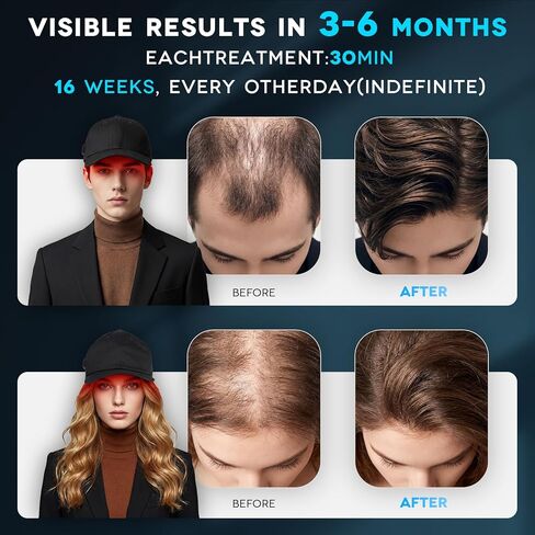 Laser Cap Hair Loss Thinning & Alopecia Treatment for Men & Women Wireless Rechargeable Red Light Therapy for Hair Growth - FDA Cleared Laser Cap for Hair Regrowth in Saudi Arabia