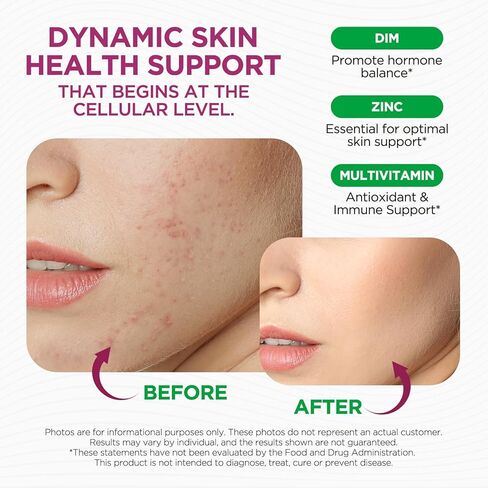 مكمل قطرات سائلة من DIM للنساء - تناغم الهرمونات للنساء ومكملات حب الشباب مع الفيتامينات المتعددة والإينوزيتول والسلفورفان - توازن الهرمونات، دعم البشرة والمزاج الشفاف، نكهة التوت المختلطة 2 أونصة سائلة in Kuwait