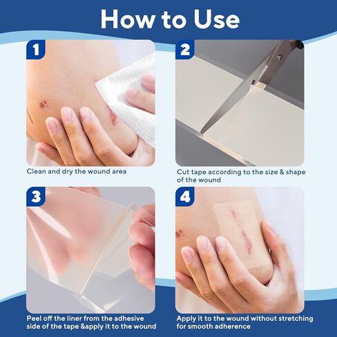 Hydrocolloid Roll for Wound Care, Flexible & Ultra Absorbent Hydrocolloid Bandages, Waterproof and Self-Adhesive Extra Large Hydrocolloid Patch Tape for Blister Care, Cut-to-Size (2 in x 16 ft) in Saudi Arabia