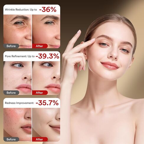 Red Light Therapy for Face, 4 Color Modes Red Light Therapy Mask, FDA-Cleared, 324 LEDs & Infrared for Anti-Wrinkle, Blue Light for Acne & Oil Control, Skin Tightening Home Skincare in Saudi Arabia
