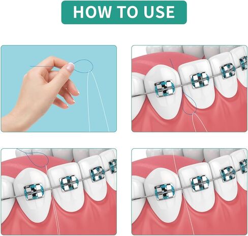 Floss Threaders for Braces, Bridges & Dental Work, 500 Count (5 Packs of 100) | Dental Floss Threader | Easy Clean Between Teeth, Braces, Retainers & Implants | Nylon, Disposable in Saudi Arabia