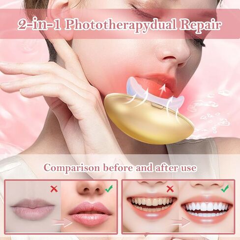 جهاز تكبير الشفاه - 2 في 1 لتفتيح الشفاه والأسنان وتقليل تجاعيد الشفاه، جهاز تكبير الشفاه السريع للنساء (ذهبي) in Kuwait