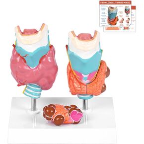 jnmftd نموذج تشريح أمراض الغدة الدرقية البشرية، حجم الحياة 4 أجزاء الغدة الدرقية التشريحية انفصال الغدة الدرقية مرض الغدة الدرقية مع بطاقة دليل قاعدة البلاستيكية القابلة للإزالة للدراسة الطبية علم وظائف الأعضاء التعليم in Kuwait