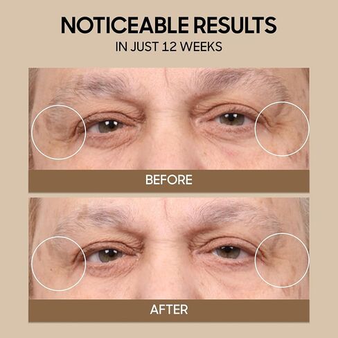 قناع الوجه العلاجي بالضوء الأحمر من Sharper Image Revel – تمت الموافقة عليه من قبل إدارة الغذاء والدواء الأمريكية وتمت دراسته سريريًا| مصابيح LED باللون الأحمر والأزرق والأشعة تحت الحمراء القريبة | العناية بالبشرة والتجاعيد وحب الشباب| أداة تجميل من السيل in Saudi Arabia