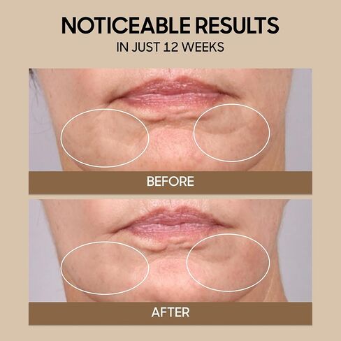 قناع الوجه العلاجي بالضوء الأحمر من Sharper Image Revel – تمت الموافقة عليه من قبل إدارة الغذاء والدواء الأمريكية وتمت دراسته سريريًا| مصابيح LED باللون الأحمر والأزرق والأشعة تحت الحمراء القريبة | العناية بالبشرة والتجاعيد وحب الشباب| أداة تجميل من السيل in Saudi Arabia