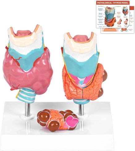 jnmftd نموذج تشريح أمراض الغدة الدرقية البشرية، حجم الحياة 4 أجزاء الغدة الدرقية التشريحية انفصال الغدة الدرقية مرض الغدة الدرقية مع بطاقة دليل قاعدة البلاستيكية القابلة للإزالة للدراسة الطبية علم وظائف الأعضاء التعليم in Kuwait