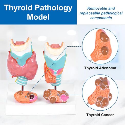 jnmftd نموذج تشريح أمراض الغدة الدرقية البشرية، حجم الحياة 4 أجزاء الغدة الدرقية التشريحية انفصال الغدة الدرقية مرض الغدة الدرقية مع بطاقة دليل قاعدة البلاستيكية القابلة للإزالة للدراسة الطبية علم وظائف الأعضاء التعليم in Kuwait