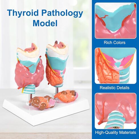 jnmftd نموذج تشريح أمراض الغدة الدرقية البشرية، حجم الحياة 4 أجزاء الغدة الدرقية التشريحية انفصال الغدة الدرقية مرض الغدة الدرقية مع بطاقة دليل قاعدة البلاستيكية القابلة للإزالة للدراسة الطبية علم وظائف الأعضاء التعليم in Kuwait