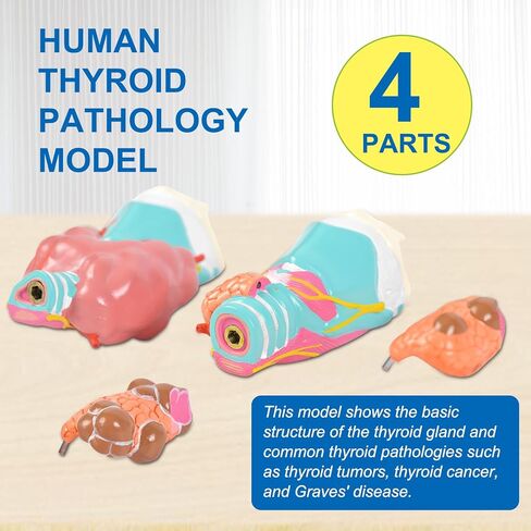 jnmftd نموذج تشريح أمراض الغدة الدرقية البشرية، حجم الحياة 4 أجزاء الغدة الدرقية التشريحية انفصال الغدة الدرقية مرض الغدة الدرقية مع بطاقة دليل قاعدة البلاستيكية القابلة للإزالة للدراسة الطبية علم وظائف الأعضاء التعليم in Kuwait